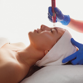 Microneedling With Salmon DNA